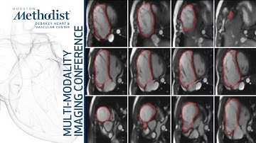 Assessment of the Right Ventricle and Right Sided Valves: CMR (Eric Yang, MD, PhD) March 2, 2021