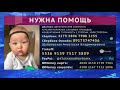 С опухолью и без слуховых проходов: малышу из Уфы срочно нужна помощь