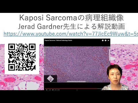 Kaposi肉腫の病理組織像の解説
