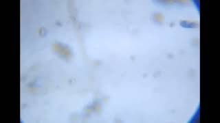 2and microbe. it's tiny. by WITH3Я 10 views 1 year ago 8 seconds