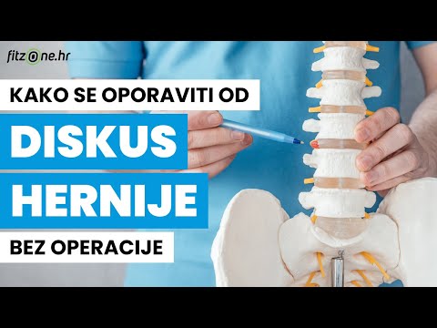 DISKUS HERNIJA (PROTRUZIJA) - kako je se riješiti BEZ OPERACIJE?