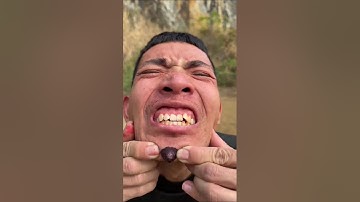 How I Cured🤪🤢😱🤔 a Bug Bite with Yogurt in the Wild | Survival Hacks