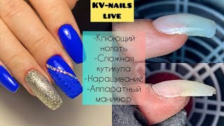 !Клюющий ноготь, сложная кутикула, наращивание! !Как сделать красивый маникюр!