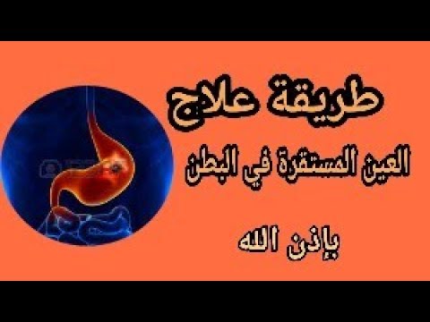 طريقة علاج العين المستقرة في البطن Youtube