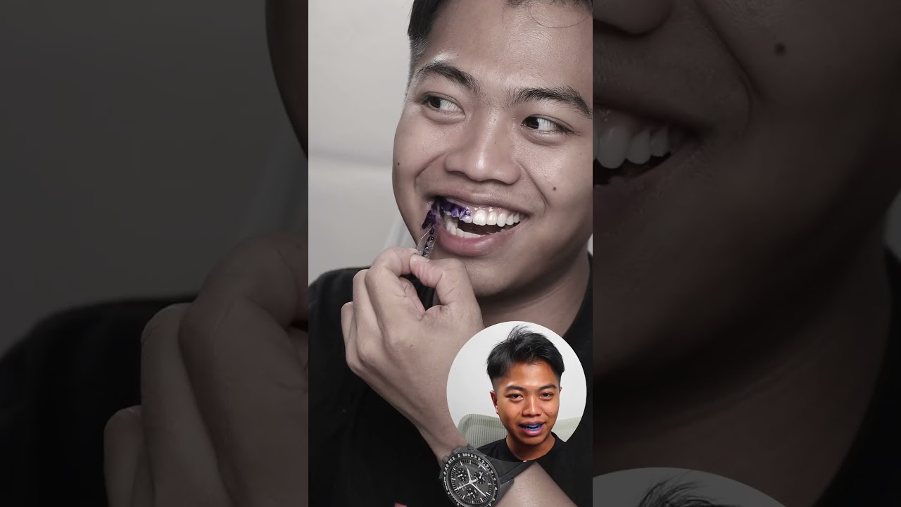 เหมือนโฆษณาจริงๆ LINEE แผ่นแปะฟัน