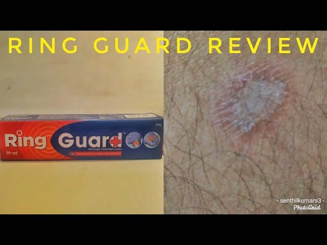 Ring Guard Ointment 20g- Skin Cream, Fungus, Jock Dhobi Itch, Anti Fungal -  Conseil scolaire francophone de Terre-Neuve et Labrador