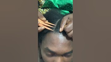 Scalp Check, Scratching. Full Video On Our YouTube Channel #asmr #asmrvideo #scalpscratching #scalp