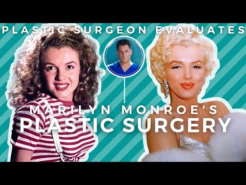 Wideo: Czy Marilyn miała endometriozę?