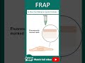 Fluorescence Recovery After Photobleaching (FRAP) | CSIR NET | Biotechniques in 1 minute