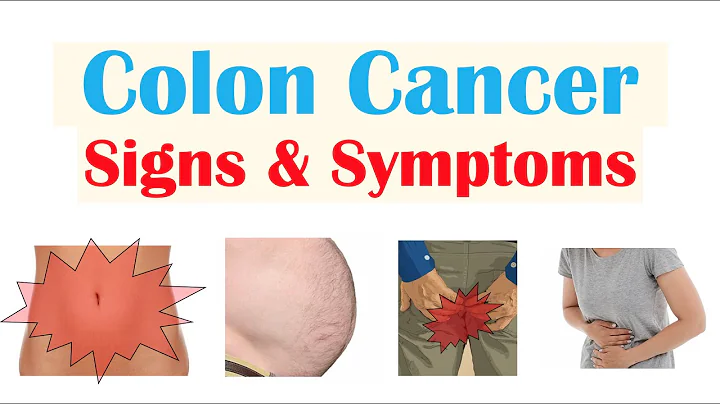 Colon Cancer (CRC) Signs & Symptoms (& Why They Occur) - DayDayNews