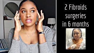 My Fibroid Story + Advice Before Getting Surgery