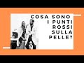 Cosa Sono I Punti Rossi Sulla Pelle?