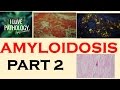 AMYLOIDOSIS: PART 2: Pathogenesis & Classification