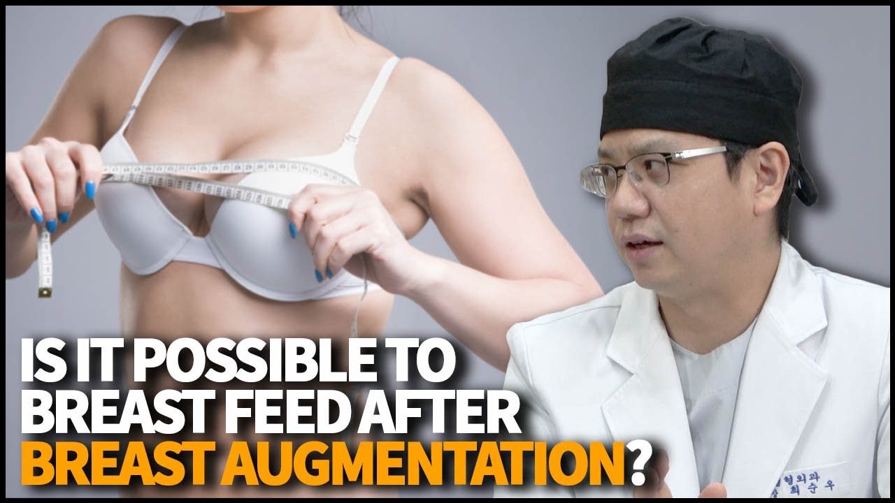 Breastfeeding after Breast Augmentation