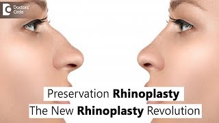 What is Preservation Rhinoplasty? - Dr. Srikanth V | Doctors' Circle