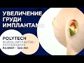 Зыков: Увеличение груди. Обьем 320 мл.