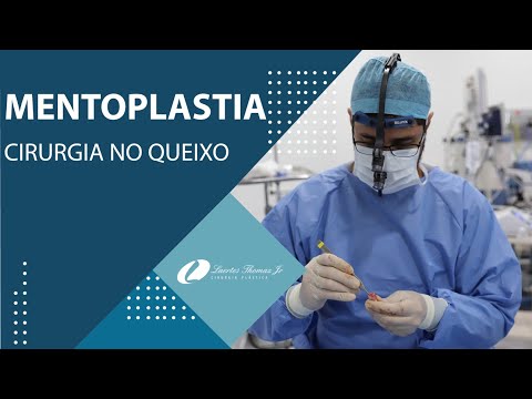 Vídeo: CoolSculpting Para O Queixo: Procedimento, Custo, Efeitos Colaterais E Fotos