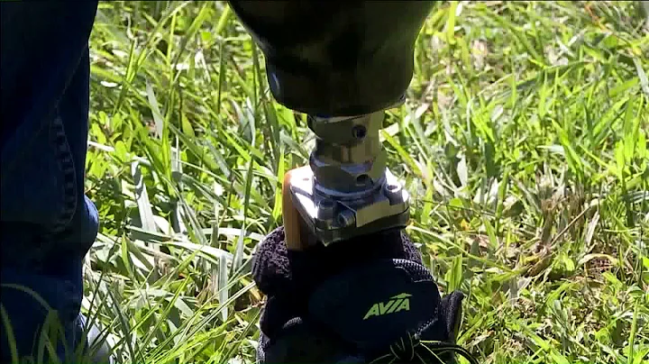 Man reunited with artificial leg