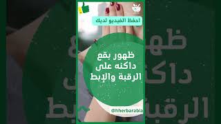 تعاني من مقاومة الانسولين #shorts