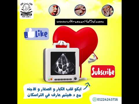 ايكو قلب الكبار و الصغار و الاجنه رباعي الأبعاد مع د هيثم عارف في التراسكان