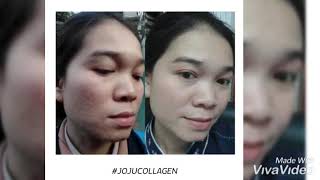 Review JOJU COLLAGEN