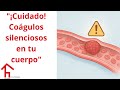 "Trombofilias Hereditarias: ¿Por Qué Tu Sangre Forma Coágulos Sin Razón? 🧬🩸"