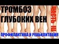 Варикозное расширение вен: часть третья