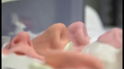 Print Your Own Nose: The Future of Prosthetics