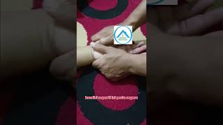 Mengurai kebas di tangan #kebas #griyasehatarrisalah
