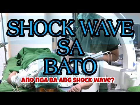 Video: Shock wave - ano ito?