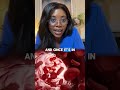 why Periodontal disease is worse than you think