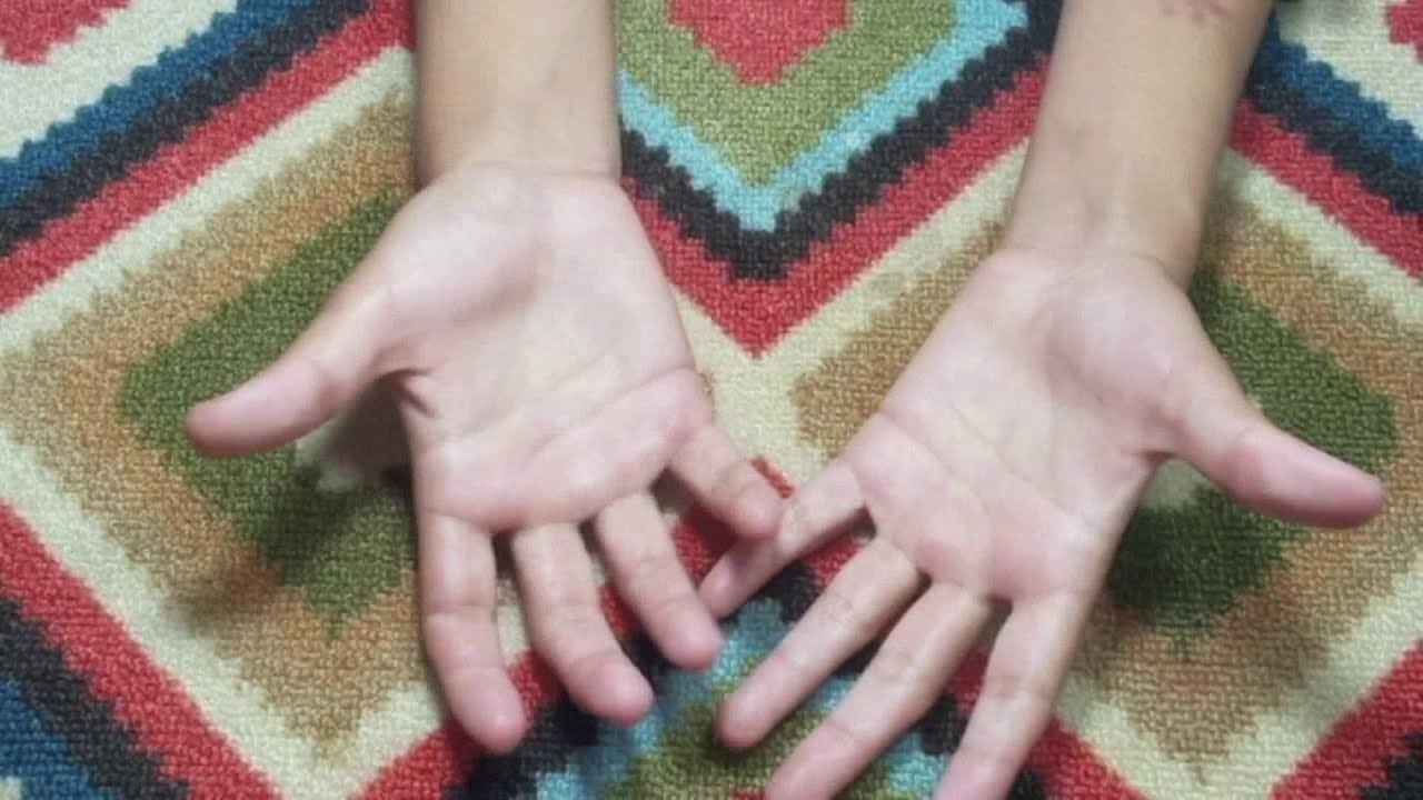 how-to-get-rid-of-stretch-marks-on-breast-amazing-breast-tips-youtube