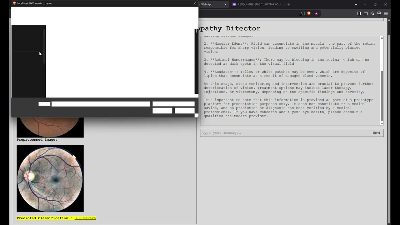 ML WebApp Diabetic Retinopathy Analysis (EfficientNetB3)