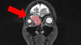 Only a few doctors know exactly what this is... for now