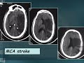 Rapid review in radiology by Dr Yousef Alkhatib مراجعة سريعه في الاشعه ل د يوسف الخطيب