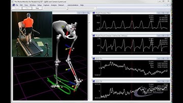 The MotionMonitor synchronous collection with qEEG data