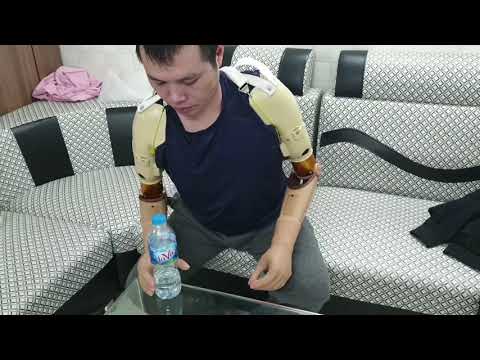 Thử và Tập tay lần đầu với hai tay giả điện sinh học trên khuỷu (Liên hệ để được tư vấn: 0985211888)