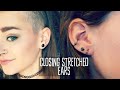 How I Closed My Stretched Ears