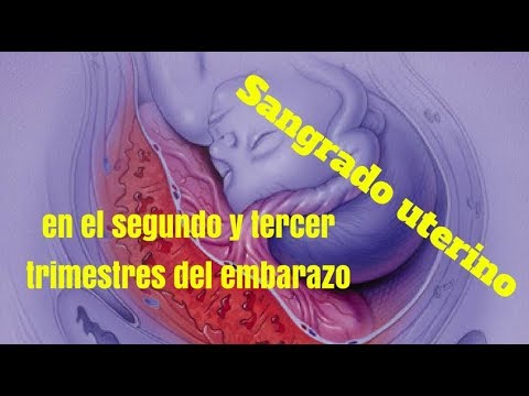 Son normales los mareos en el tercer trimestre de embarazo Son normales los mareos en el tercer trimestre de embarazo