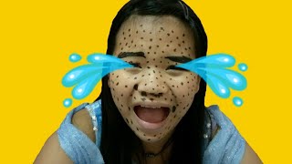 ไฝประหลาดขึ้นเต็มหน้า ใครก็ได้ช่วยซินเดอเรลล่าที/Jade Channel screenshot 1