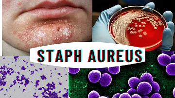 Staphylococcus aureus | staphylococcus infection - causes, symptoms
