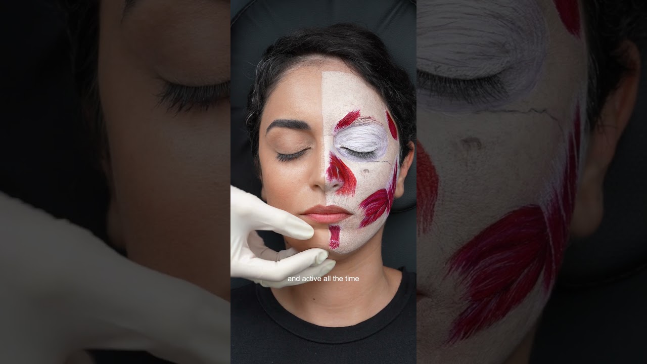 Botox for dimpling chin appearance