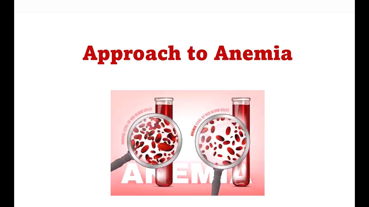 Approach to anemia in pediatrics Dr Mai Abdelsalam Lecturer of pediatrics Cairo university
