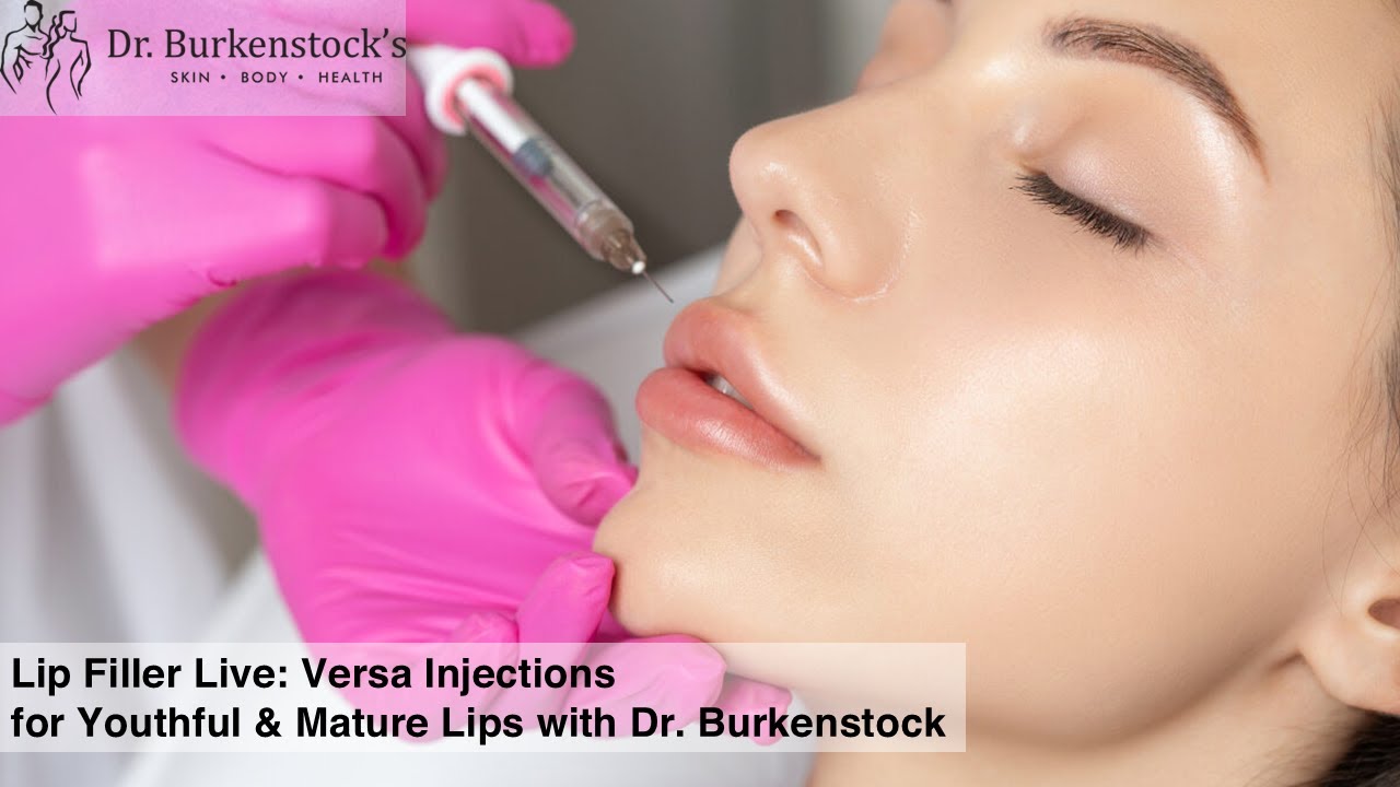 Lip Filler Live: Versa Injections for Youthful & Mature Lips with Dr. Burkenstock