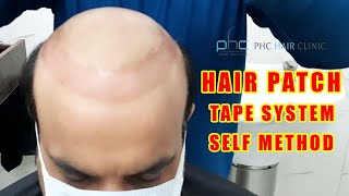 How To Do Hair Patch Service Taping System Self Method Call 91 9899746489