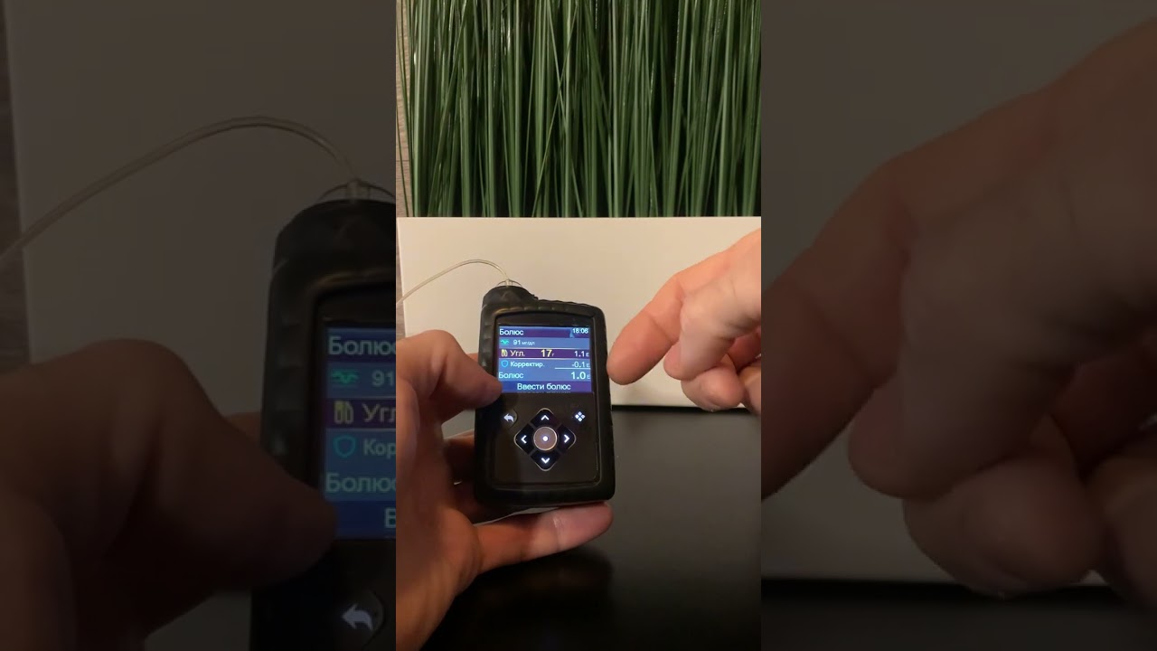 Ответы на вопросы. Medtronic 780g