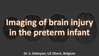 Imaging the preterm brain! Periventricular leukomalacia and beyond.