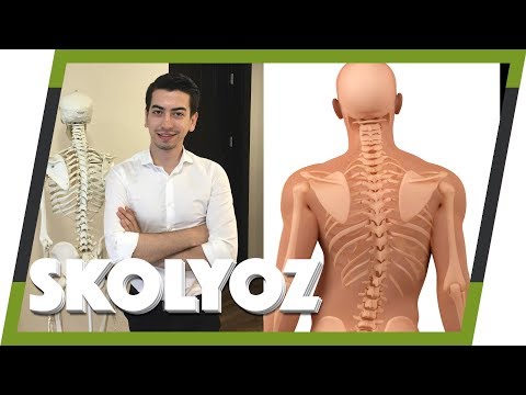 SKOLYOZ NEDİR? SKOLYOZ TEDAVİSİ İÇİN BİLMEN GEREKENLER! (FZT. CEM KOÇAK İLE AĞIRSAĞLAM LABS #1)