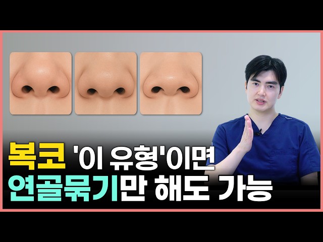 코수술 대신 코끝 연골만 묶으면? 복코의 종류와 복코를 교정하는 수술 방법