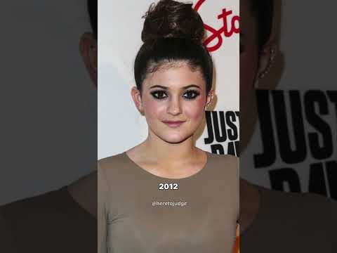 Kylie jenner’s surgery evolution through the years #shorts